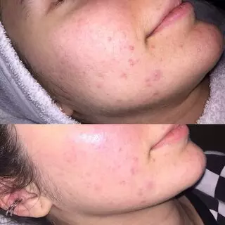 Esthetics By Georgina