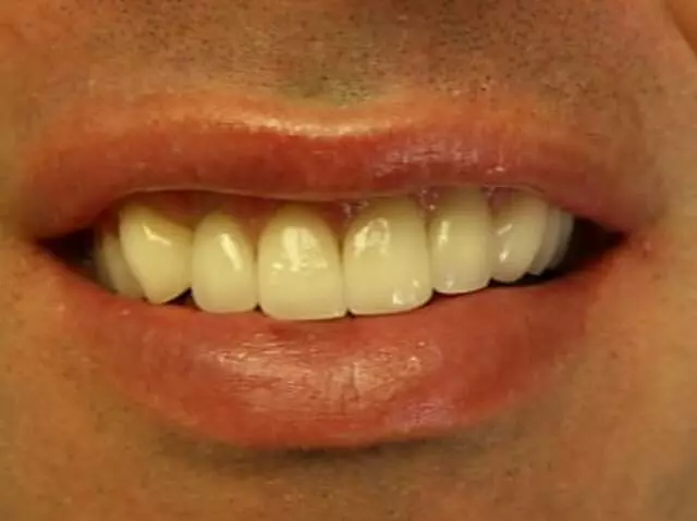 Allure Dental Laboratory