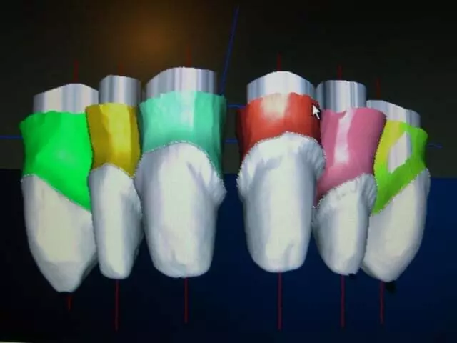 Allure Dental Laboratory