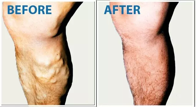 USA Vein Clinics