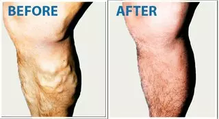 USA Vein Clinics