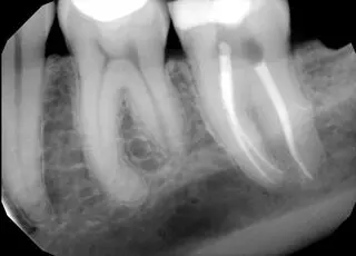 Three Rivers Endodontics
