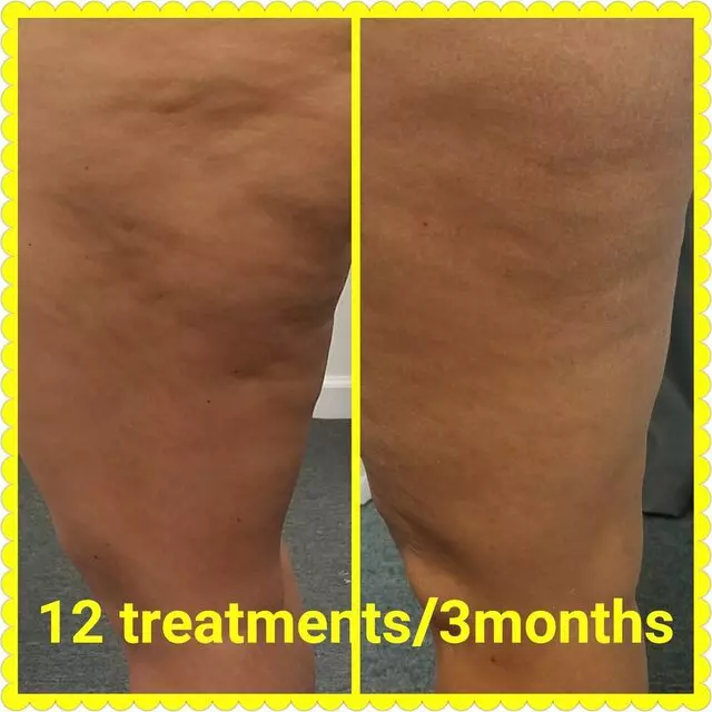 Anastasia’s Crown Esthetic Services